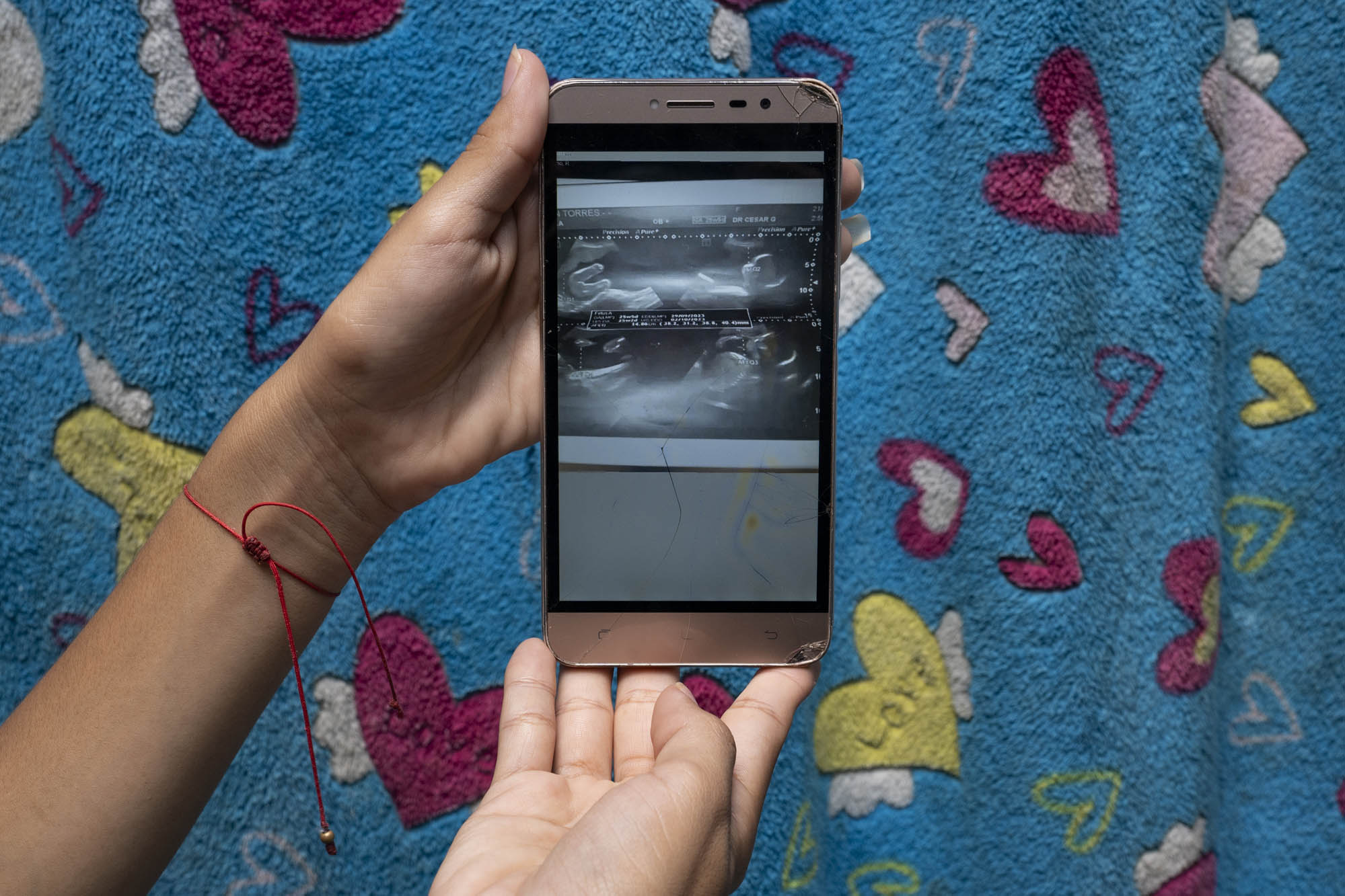 El embarazo adolescente secuestra la infancia - Colombia